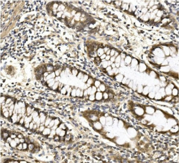 Aconitase 1 Antibody