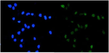 Topoisomerase II alpha Antibody / TOP2A