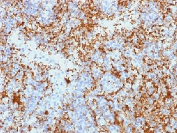 IHC testing of FFPE human spleen tissue with CD61 antibody (clone Y2/51). Required HIER: boil tissue