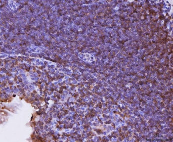 IHC staining of FFPE mouse intestinal lymph node tissue with Cxcr3 antibody. HIER: boil tissue secti