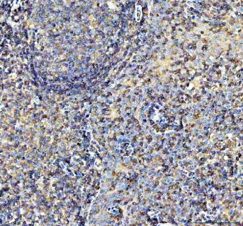 IHC staining of FFPE human tonsil tissue with AIRE antibody. HIER: boil tissue sections in pH8 EDTA 