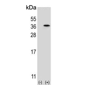 Western blot testing of 1) non-transfected and 2) transfected 293 cell lysate with Speedy protein A 