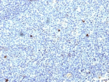 IHC: Formalin-fixed, paraffin-embedded human tonsil stained with HLA-Aw32 / HLA-A25 antibody (SPM418