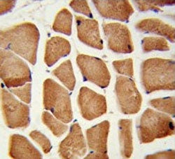 Enoyl-CoA delta isomerase 2 Antibody / ECI2 / PECI
