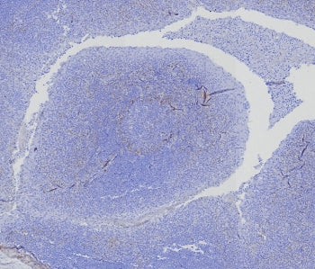IHC staining of FFPE human tonsil tissue with recombinant BCMA antibody (clone CD269/8276R). HIER: b