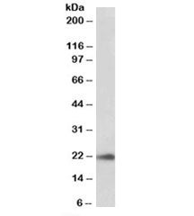 TMEM205 Antibody