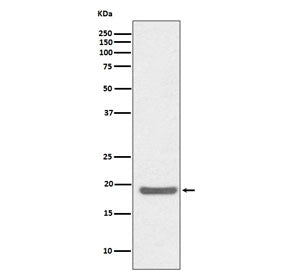Western blot testing of human Jurkat cell lysate with SOD1 antibody. Predicted molecular weight ~16 