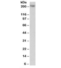 Western blot testing of Jurkat lysate with MYO5A antibody at 1ug/ml. Predicted molecular weight: ~21
