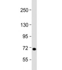 Western blot testing of human 293T/17 cell lysate with L3MBTL4 antibody at 1:2000. Predicted molecul