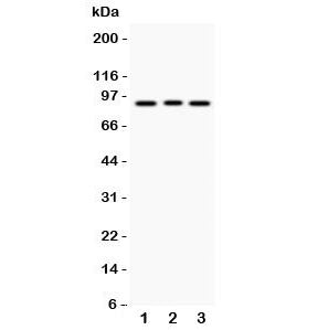 Western blot testing of SEMA3A antibody and Lane 1: 293T; 2: A549; 3: HeLa lysate. Predicted molecul