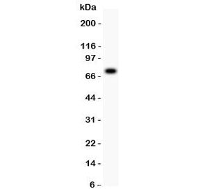 5-Lipoxygenase Antibody