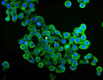 Immunofluorescent staining of FFPE human Caco-2 cells with EIF4A1 antibody (green) and DAPI nuclear 