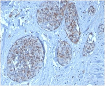 IHC staining of FFPE human pancreatic tissue with MDM2 antibody (clone MDM2/3277). HIER: boil tissue