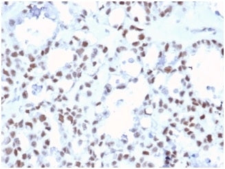 MLH1 Antibody / MutL Homolog 1