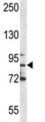 MPO Antibody (Myeloperoxidase)