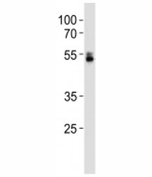 RUNX1 Antibody