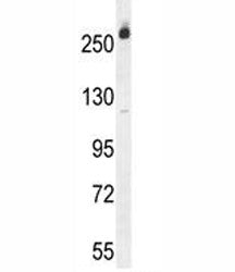 CAD Protein Antibody