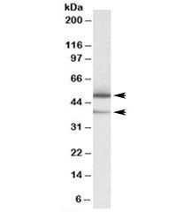 Western blot testing of human lymph node lysate with TXNDC5 antibody at 0.05ug/ml. Isoforms of ~48kD