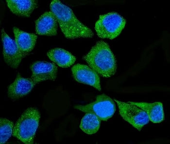 EIF2AK2 Antibody / PRKR / PKR