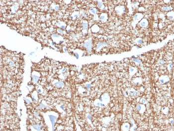 IHC staining of FFPE human brain with Myelin Basic Protein antibody (clone MBP/4273). HIER: boil tis