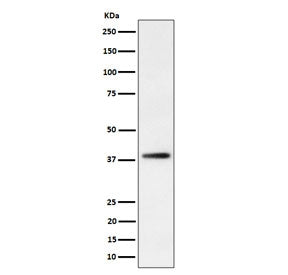 FDPS Antibody / Farnesyl Diphosphate Synthase