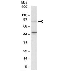 WHIP Antibody