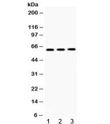 Western blot testing of 1) rat brain, 2) mouse brain and 3) human U-2 0S lysate with TCP1 theta anti