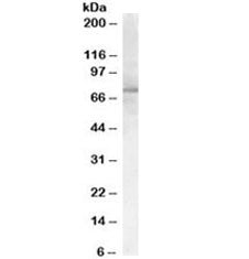 PCSK9 Antibody