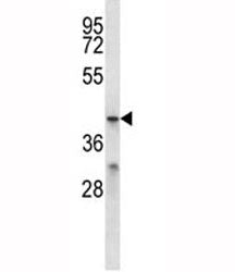 MFSD2B Antibody