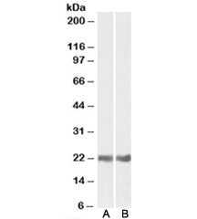 Western blot testing of mouse [A] and rat [B] eye lysates with CRYAB antibody at 0.05ug/ml. Predicte