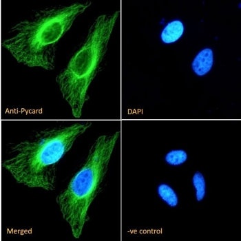 Immunofluorescent staining of fixed and permeabilized human HeLa cells with ASC antibody (green) at 