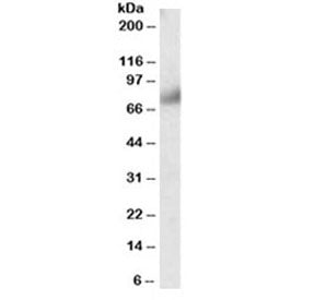 Western blot testing of human breast lysate with FGFR1 antibody at 0.3ug/ml. Predicted molecular wei