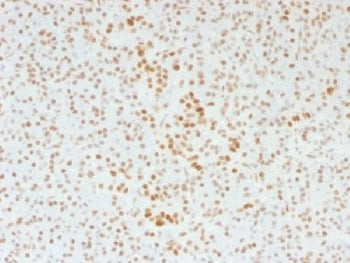 ATRX Antibody / RAD54