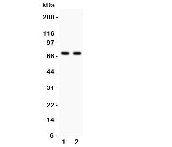 Western blot testing of SHBG antibody and Lane 1: HeLa; 2: COLO320; Predicted size per AA content: 4