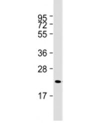 Irisin Antibody / FNDC5