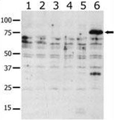 Western blot analysis of PAK6 antibody in lysate from transiently transfected COS7 cells. Lane 1: ne