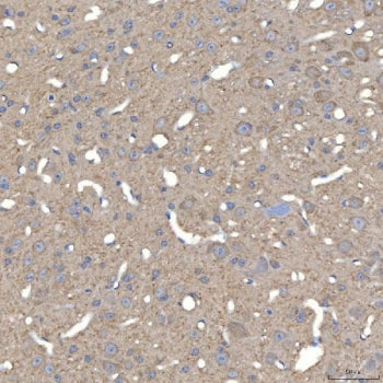 SLC25A23 Antibody / Mitochondrial ATP-Mg/Pi carrier protein 2