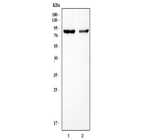 ATR Antibody / Anthrax toxin receptor / TEM8