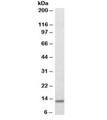 Beta-2-microglobulin Antibody