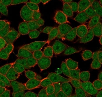 Immunofluorescent staining of PFA-fixed human HeLa cells using ZNF81 antibody (green, clone PCRP-ZNF