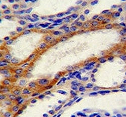 STIM1 Antibody