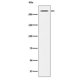 TG Antibody / Thyroglobulin