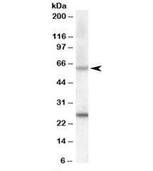Western blot testing of mouse heart lysate with COL4A3BP antibody at 0.5ug/ml. Predicted molecular w