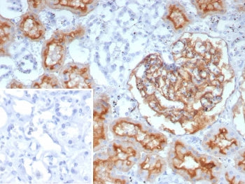 CD10 Antibody / Neprilysin