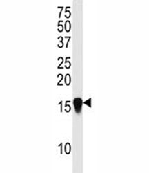 Western blot analysis of SUMO4 antibody (M55 Wild type) in HepG2 lysate. Observed molecular weight: 