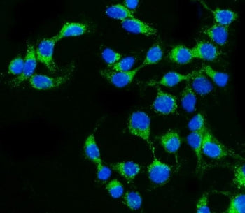 Claudin 2 Antibody / CLDN2