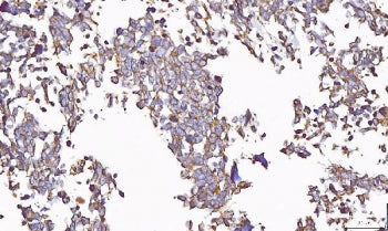 PP11 Antibody / ENDOU / Uridylate-specific endoribonuclease