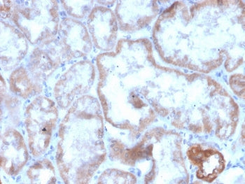IHC staining of FFPE human kidney with recombinant CD137 antibody (clone r4-1BB/4603). HIER: boil ti