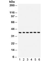 Western blot test of 1) rat brain, 2) human HepG2, 3) (h) SMMC, 4) (h) U87, 5) (h) placenta, 6) (h) 