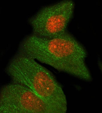 PRDM8 Antibody / PR domain zinc finger protein 8